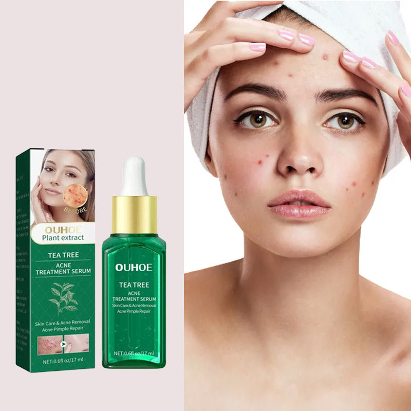 Serum Za Lečenje Akni Sa Uljem Čajevca